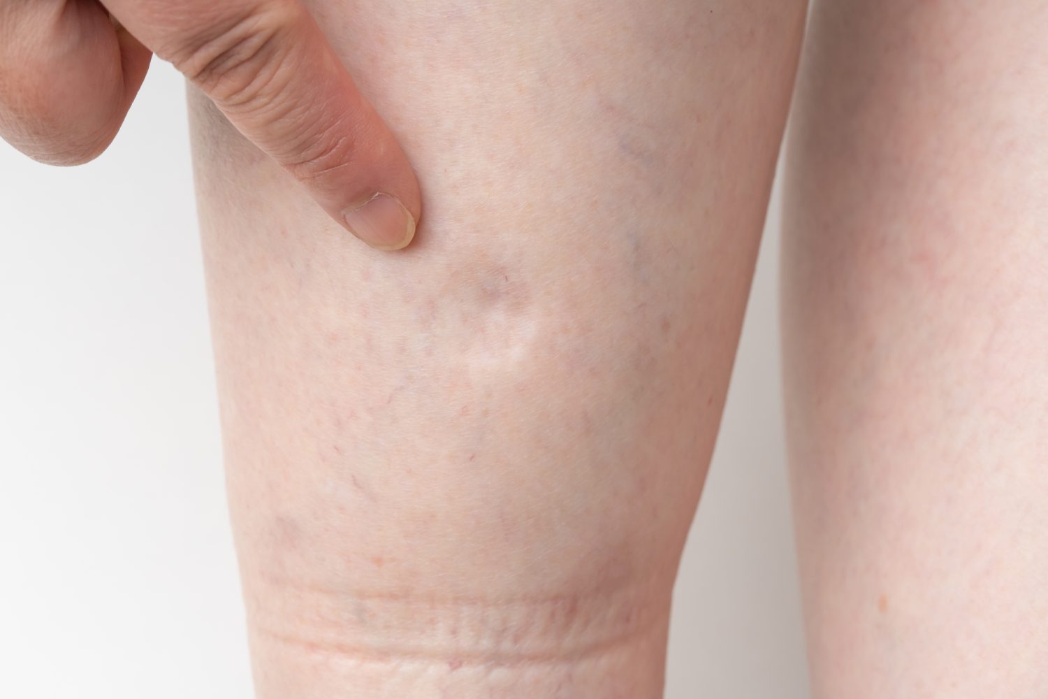 どんな症状が出たら要注意？ 受診の目安は？