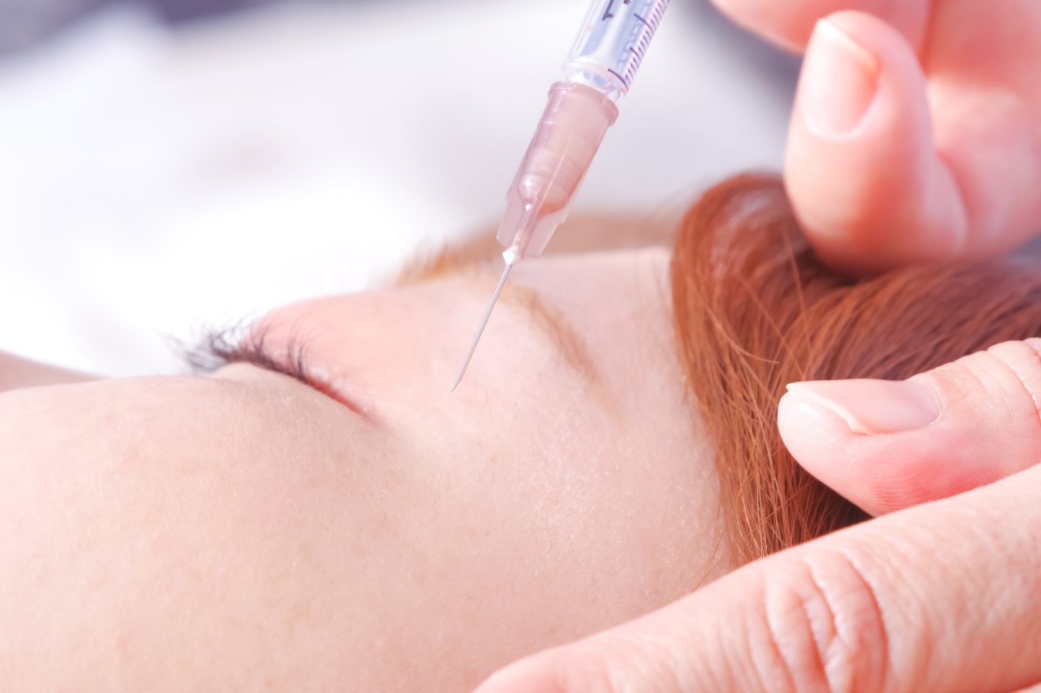 ボトックス注射の施術の流れとポイントを教えて！