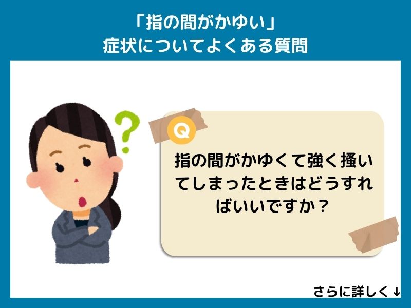 「指の間がかゆい」症状についてよくある質問