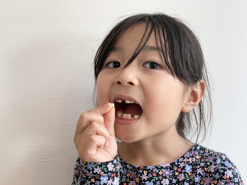 歯がぬけた女の子