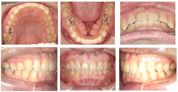西落合リーフ歯科・矯正歯科