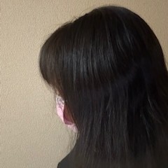 【闘病】「一生治らない」女子高生を襲う『全身性エリテマトーデス』死を考える孤独