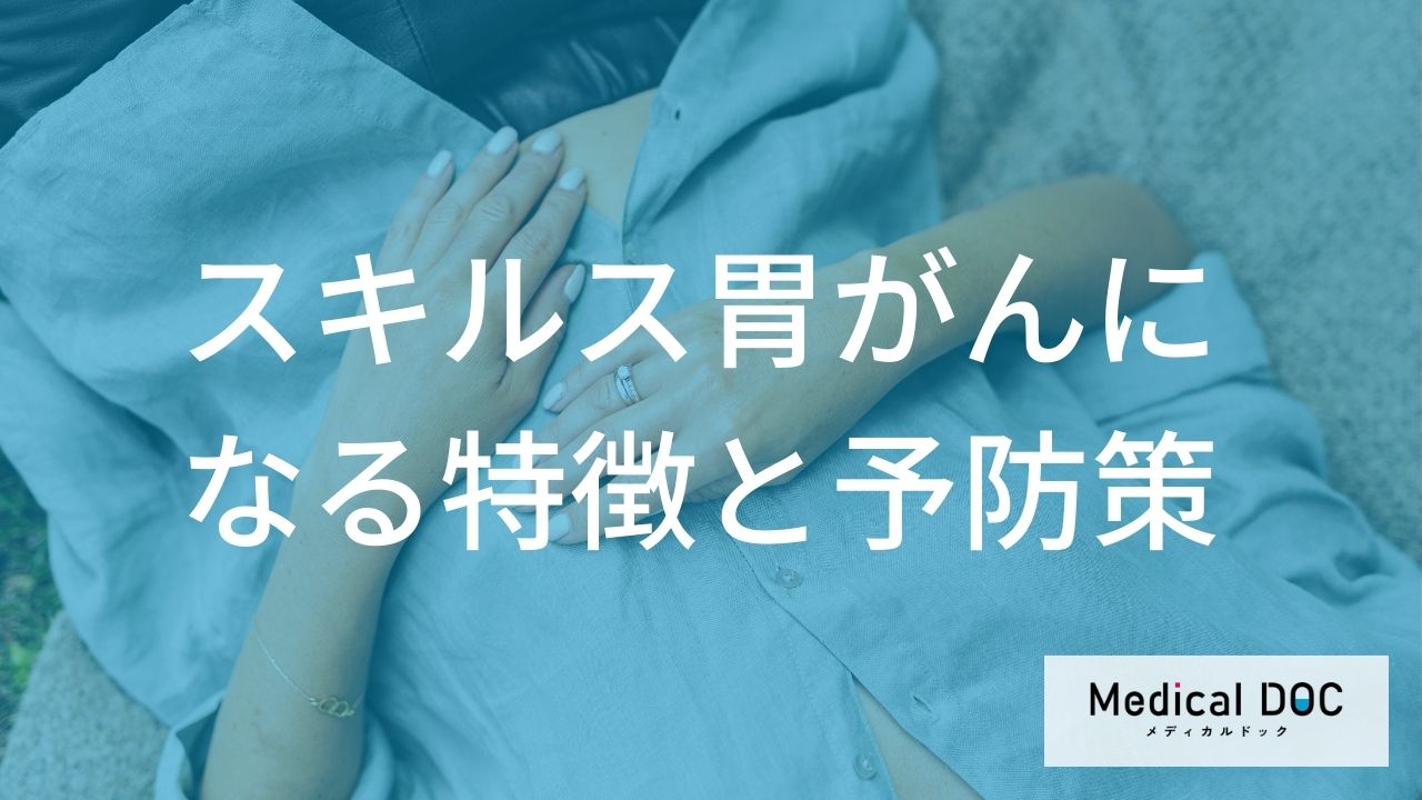 スキルス胃がんになりやすい方の特徴とリスク軽減のための予防策
