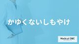 「かゆくないしもやけ」は単なる冷えではない？ 指先の変色や不調の正体を医師が解説！