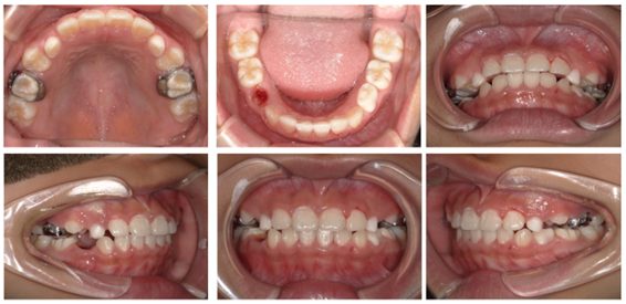 西落合リーフ歯科・矯正歯科
