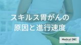 スキルス胃がんの原因と進行速度の特徴を知る