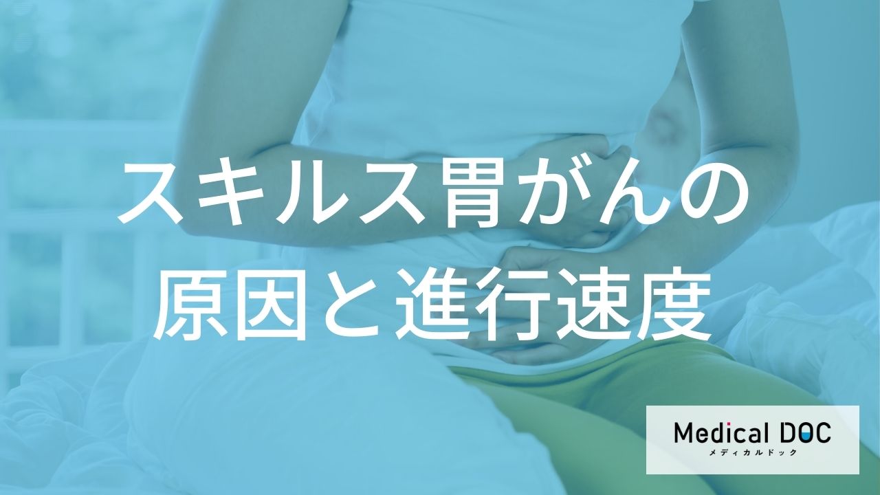 スキルス胃がんの原因と進行速度の特徴を知る