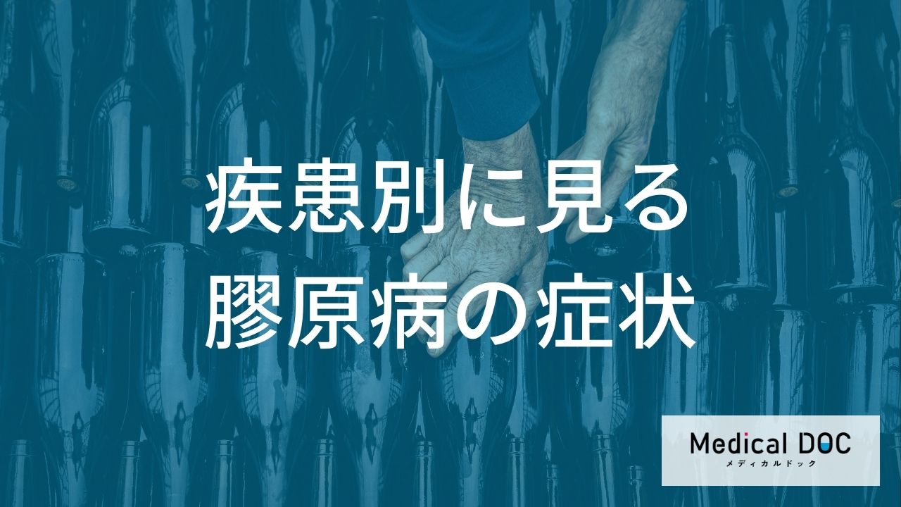 膠原病にはどんな疾患がある? 関節リウマチやSLEなど代表的な膠原病の違いを医師が解説