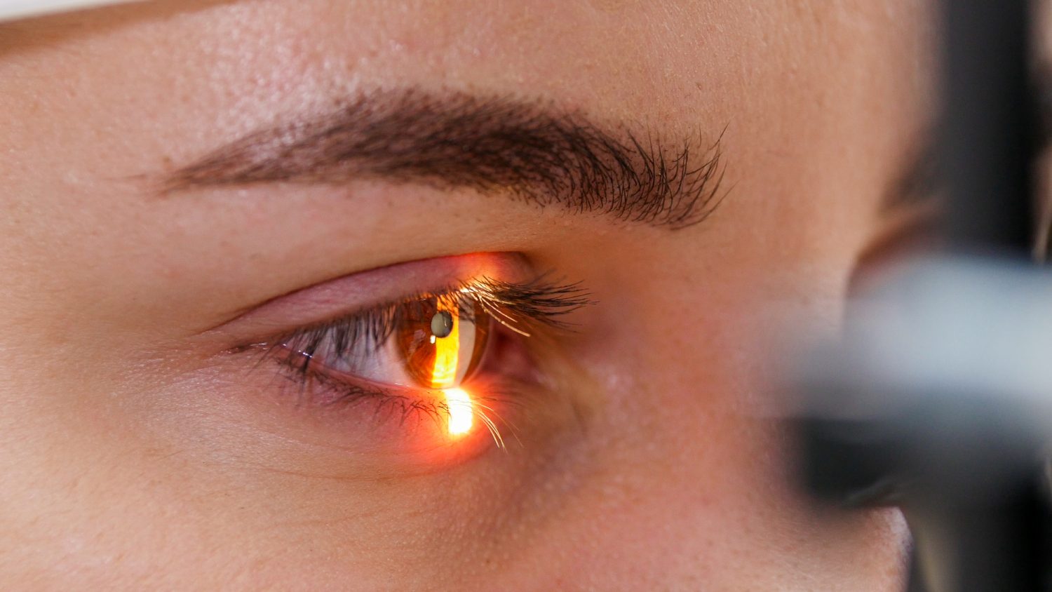 オルソケラトロジー、具体的に何をするか教えて!