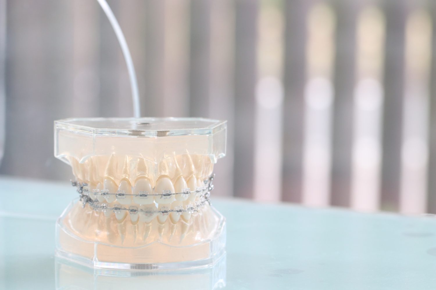 ワイヤー矯正を始めると日常はどう変わる? 痛みや違和感、生活への影響