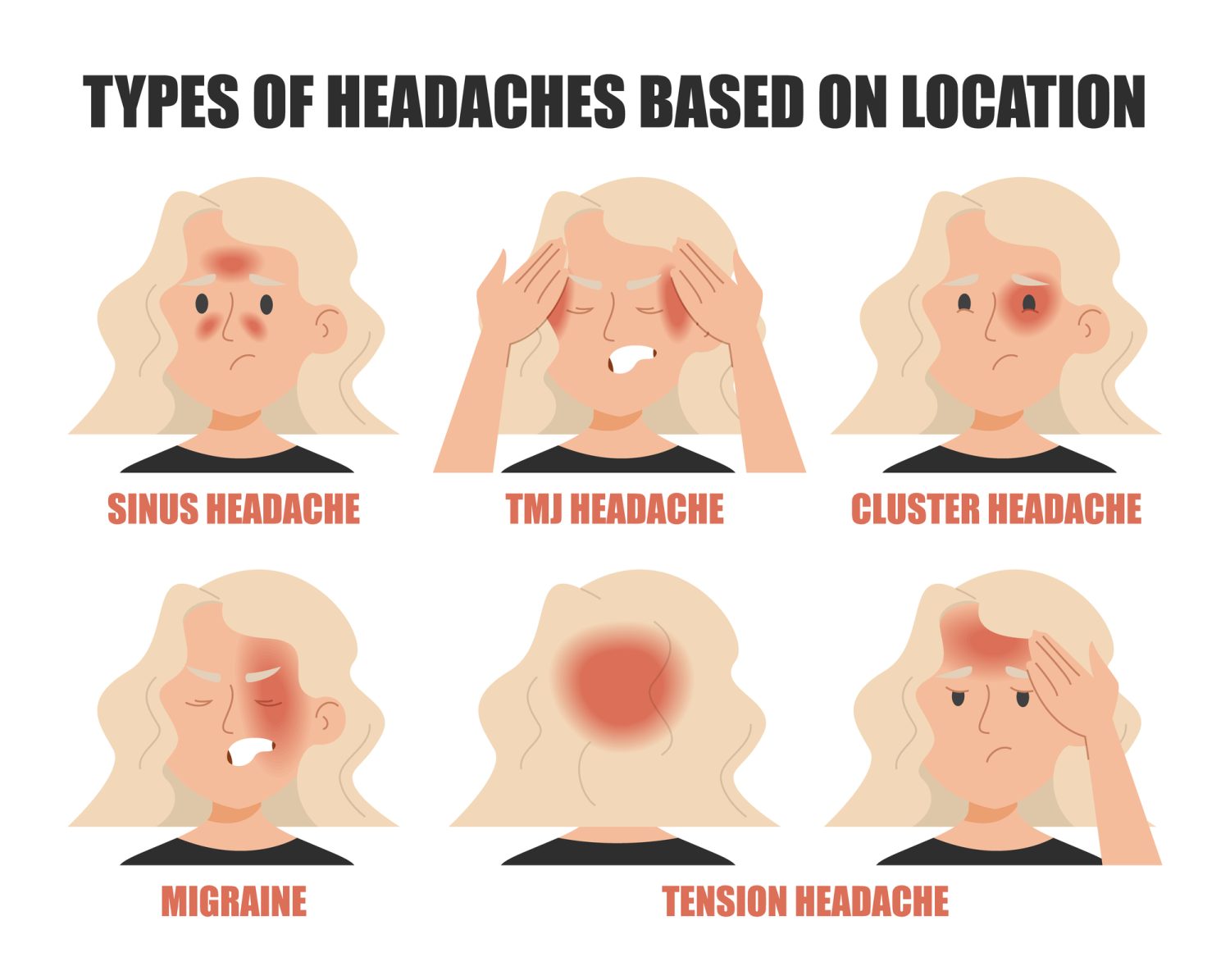 一次性頭痛の種類と片頭痛の特徴