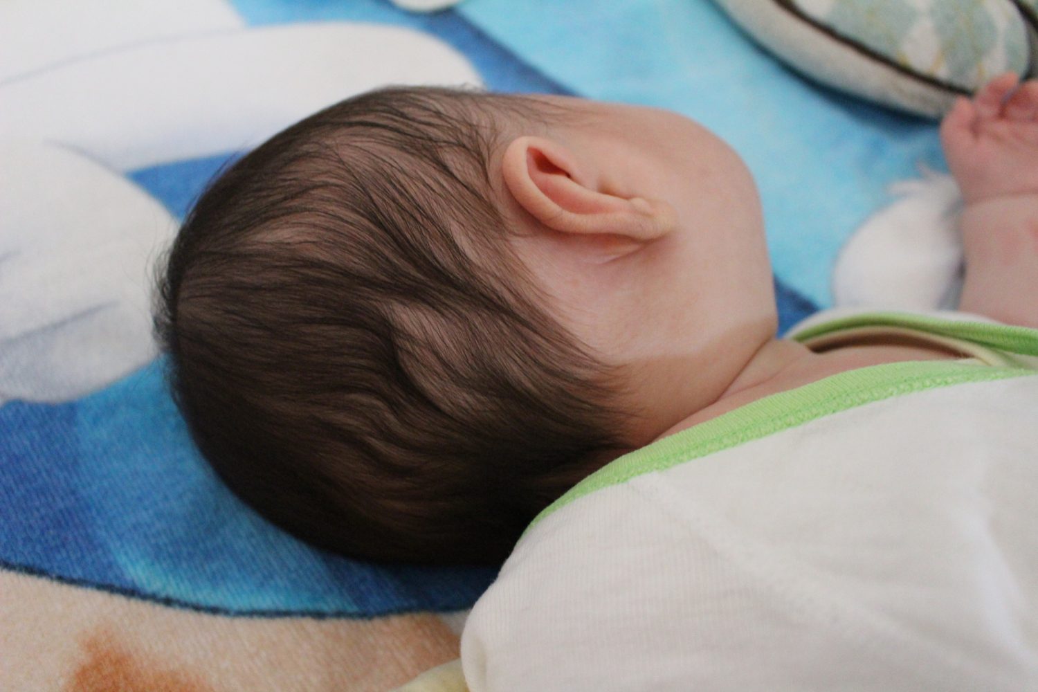 赤ちゃんの頭のゆがみ、医師が解説！