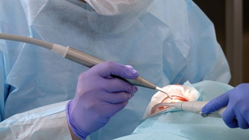 『インプラント手術』の「痛み」はどれくらい？ 対策とケア方法を解説【医師監修】