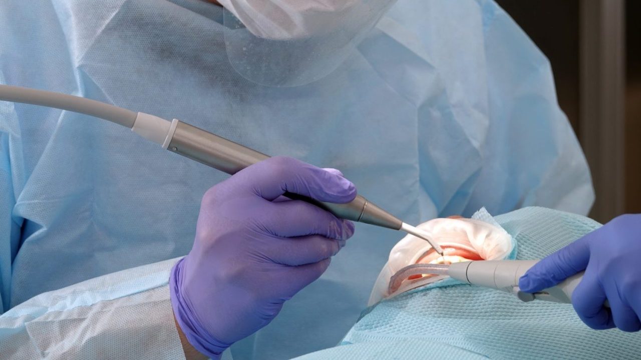 『インプラント手術』の「痛み」はどれくらい？ 対策とケア方法を解説【医師監修】