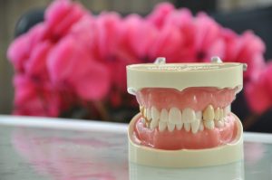 前歯のねじれは部分矯正で治せる？治療期間や費用も併せて解説