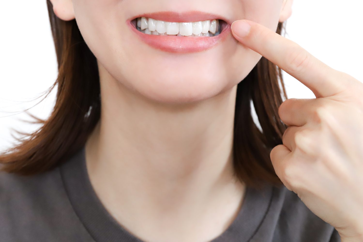 叢生における歯並びの重症度の基準