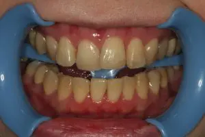 マニーデンタル