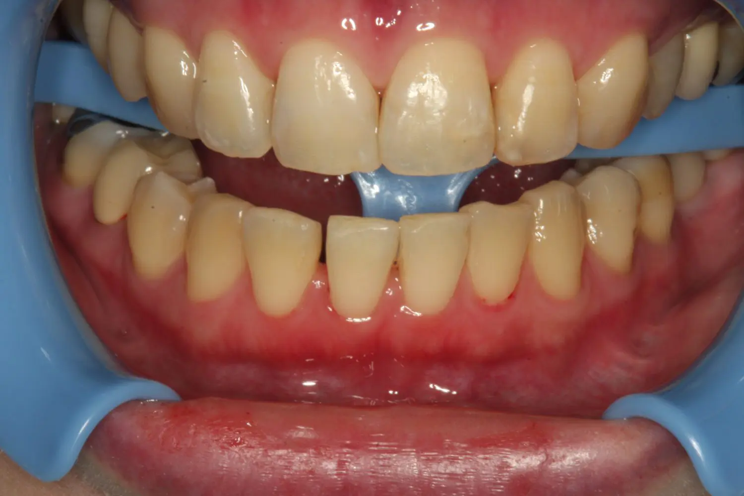 マニーデンタル