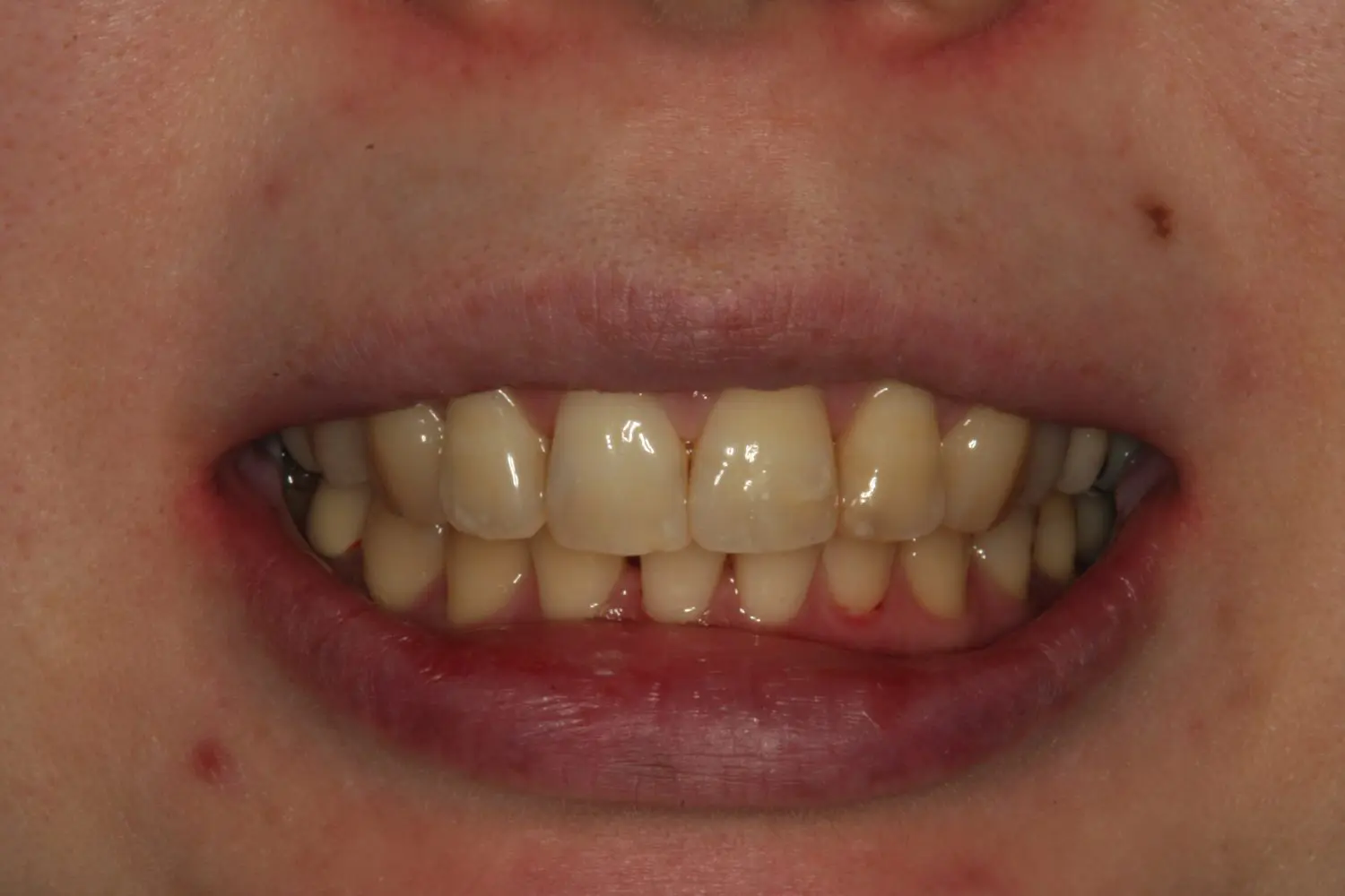 マニーデンタル