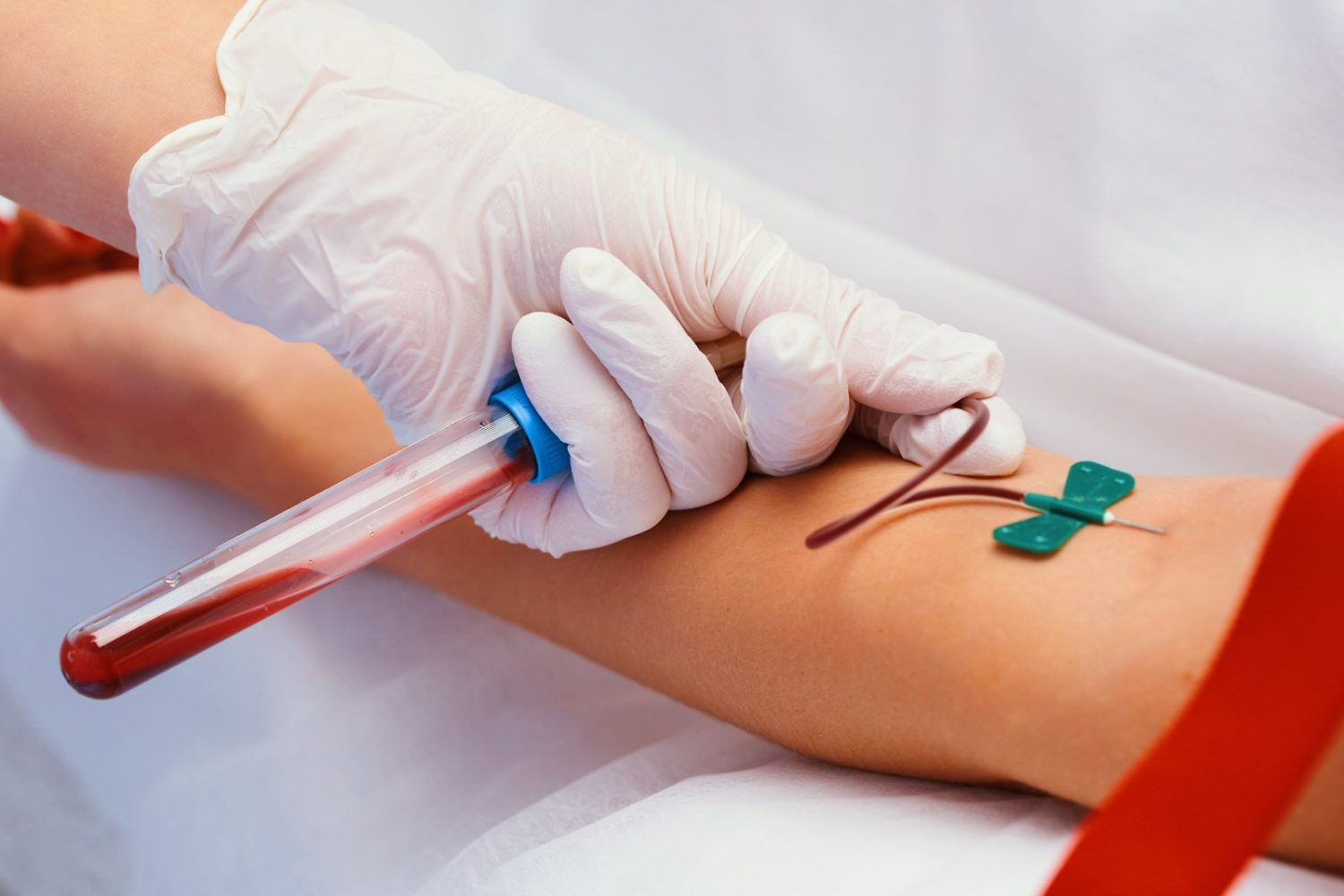 麻疹の抗体検査を受ける方法と検査の流れ