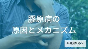 「膠原病」は初期だと診断が難しい？関節の痛みなど”疾患ごとの症状の違い”も医師が解説！