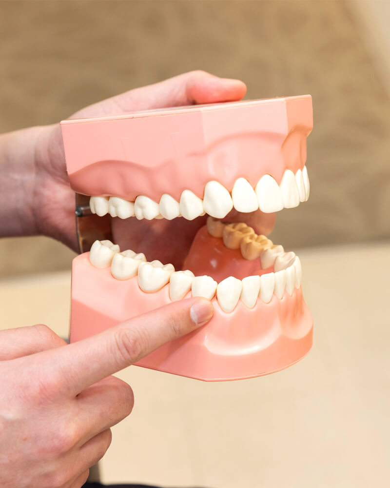 歯を失ってわかる予防の重要性。悪くなる・失う前に伝えたい