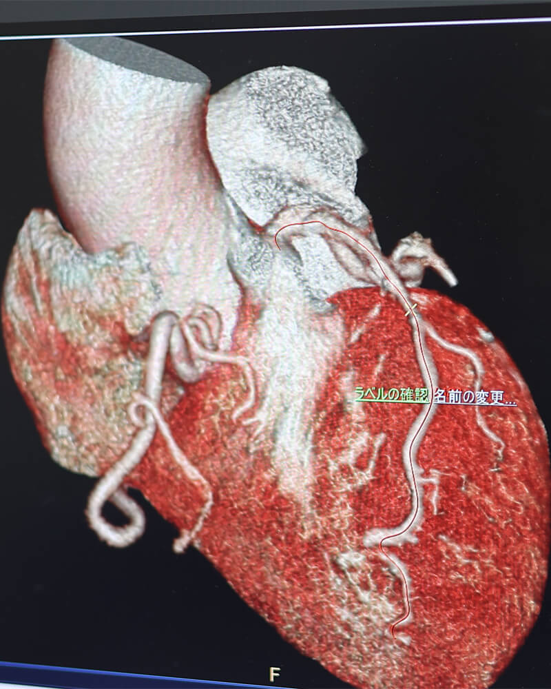 突然死のリスクを下げるため、迅速な検査でスムーズな治療へ