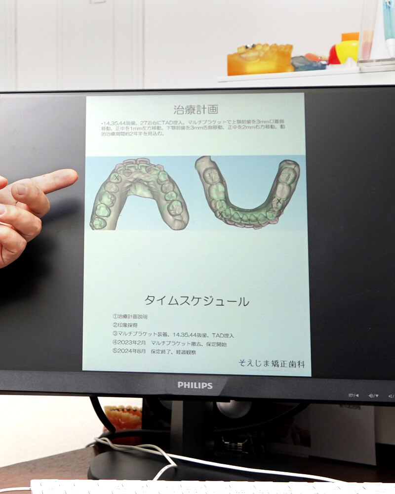 矯正治療の成功は、患者と歯科医師の相互の信頼関係から