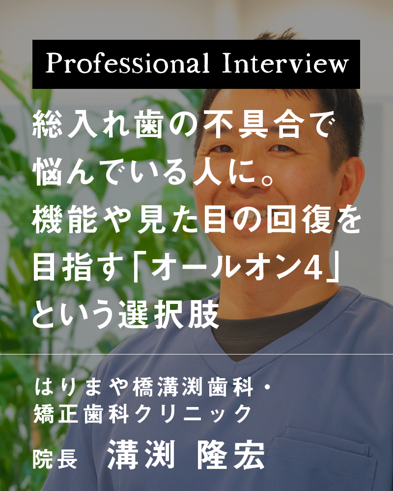 総入れ歯の不具合で悩んでいる人に。機能や見た目の回復を目指す「オールオン4」という選択肢【高知市はりまや町 はりまや橋溝渕歯科・矯正歯科クリニック】