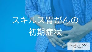 スキルス胃がんの初期症状と進行時に現れるサイン