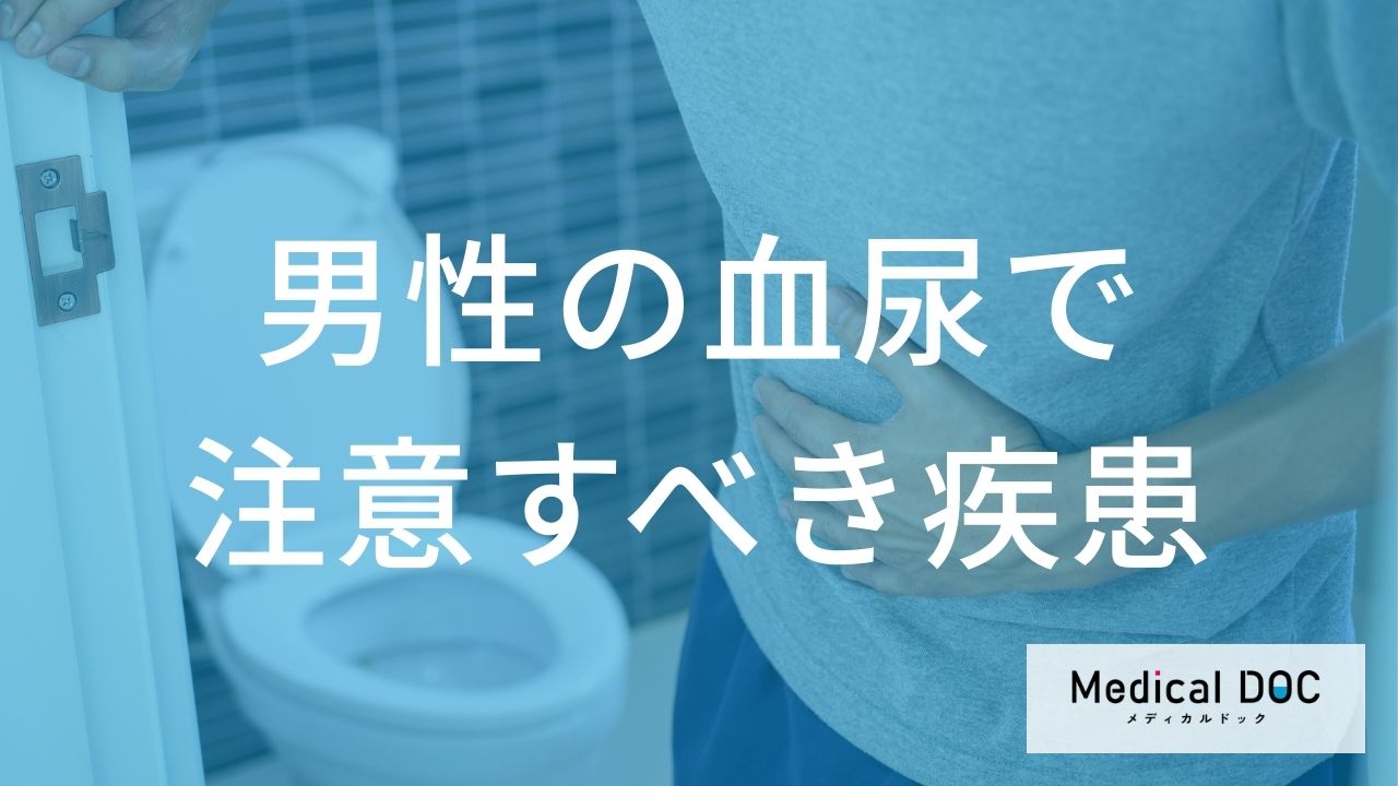 ”何色の尿”が出たら「腎がん」の前兆？男性が注意したい血尿や腰痛を解説！