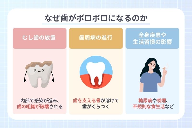 なぜ歯がボロボロになるのか