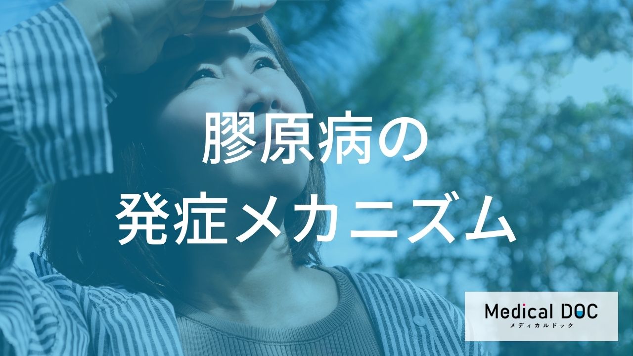 膠原病の前兆症状を医師が解説! 日光過敏やウイルス感染後に注意したい免疫異常のサインとは