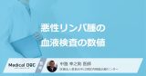 「血液検査で悪性リンパ腫」がわかる？ 確認すべき“5つの数値”を医師が解説！