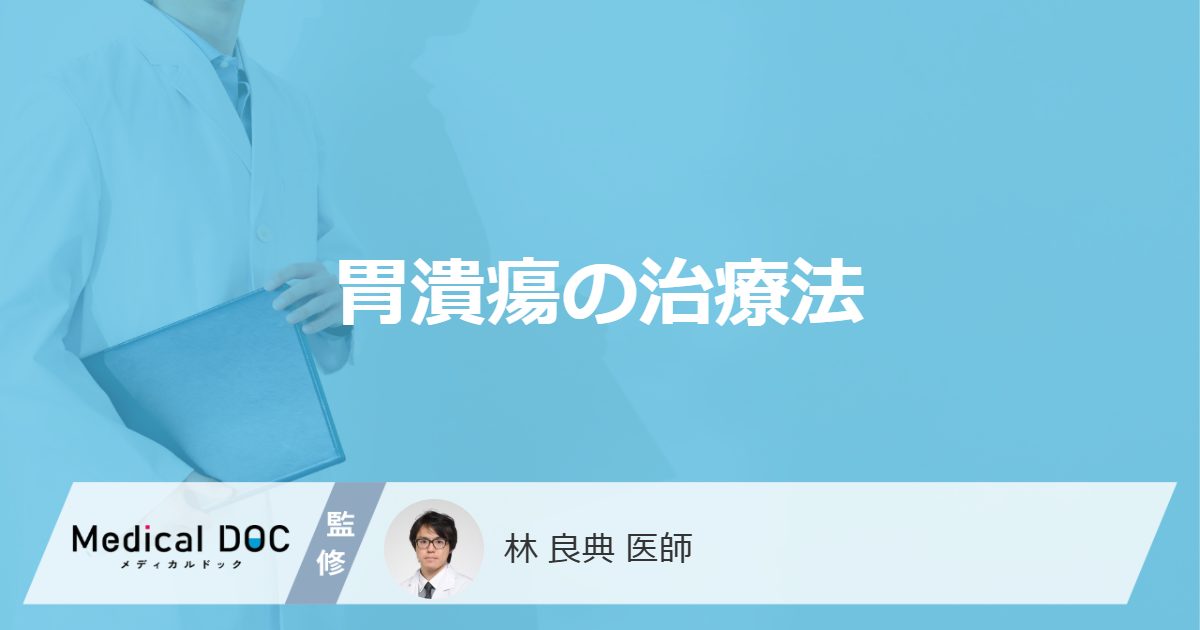 「胃潰瘍の治療法」はご存知ですか？治療中に避けた方がよい食べ物や飲み物も解説！