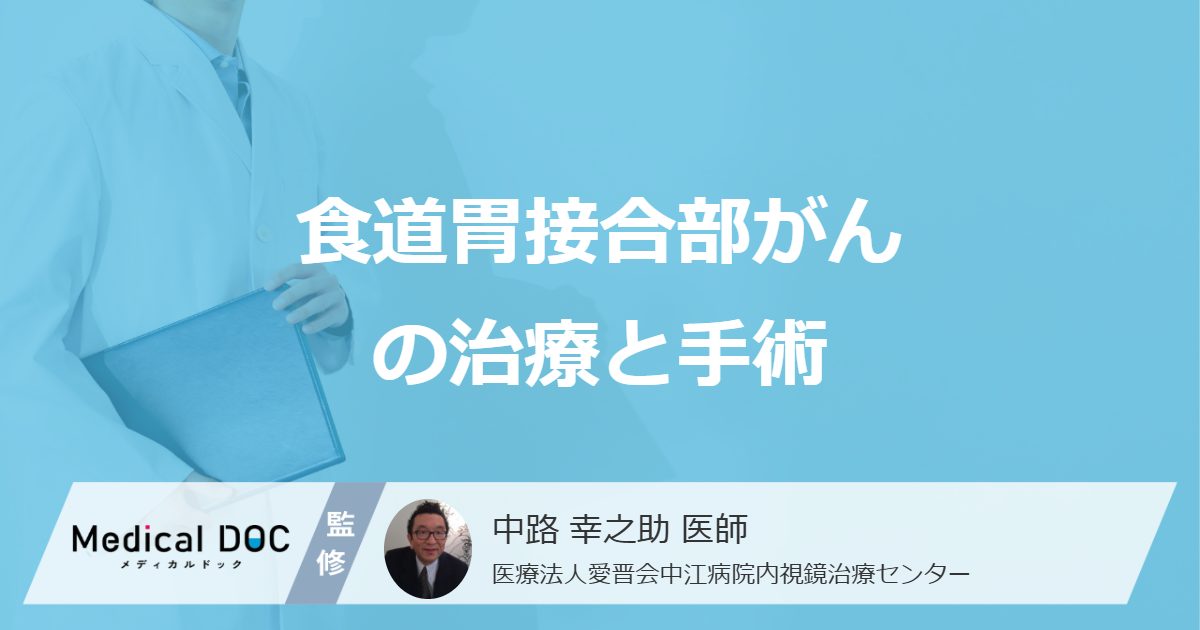 「食道胃接合部がん」の手術は難しい？ ”進行度で変わる治療法”を医師が解説！