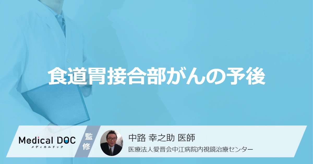 「食道胃接合部がん」はリンパ節に転移しやすい？ 生存率を医師が解説！