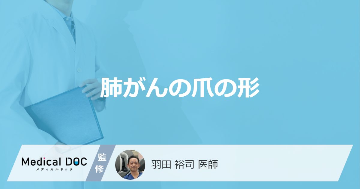 肺がんの爪の形