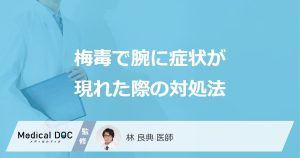 梅毒で腕に症状が現れた際の対処法