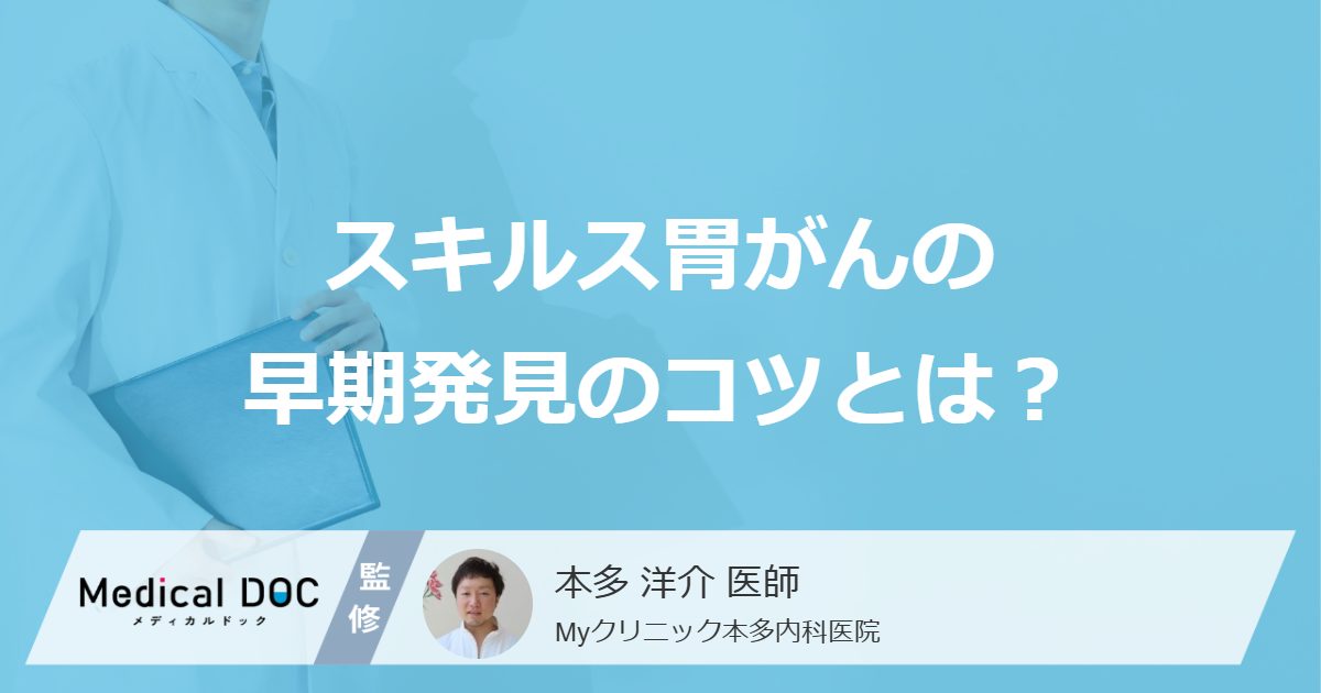 進行した「スキルス胃がん」を疑う”7つの症状”とは?早期発見のコツを解説!