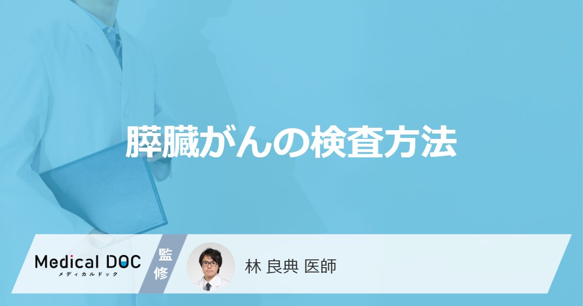 血液検査やCT検査で「膵臓がん」が分かるかご存じですか？検査内容を医師が解説！