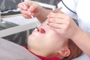 GBR法の術後に気をつけることは？腫れや痛みの対処法、術後の注意点などを解説