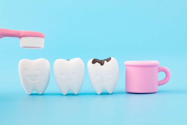 むし歯の初期症状から重度までの進行段階