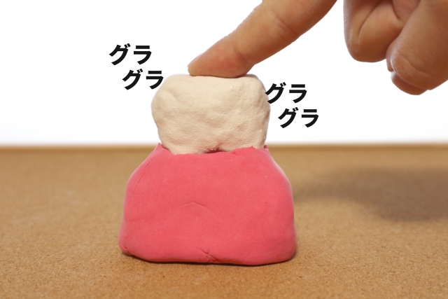 歯周病はどのような病気？