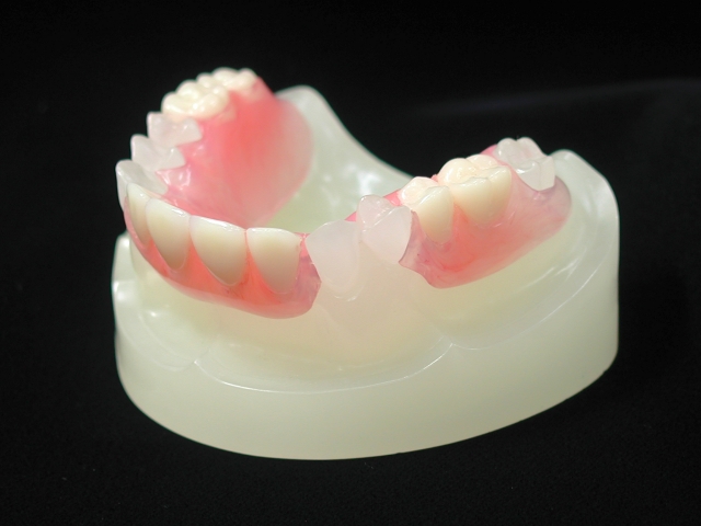 入れ歯とは