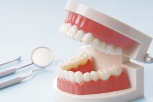 むし歯治療の流れとは？症状の進行に応じた治療法の違いを解説