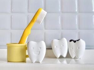 むし歯が再発する原因とは？再発のリスクを高める要因などを解説