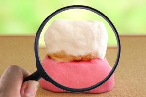 歯周病の治療回数はどのくらい？1回で治療が終わらない理由や通院の目安を解説