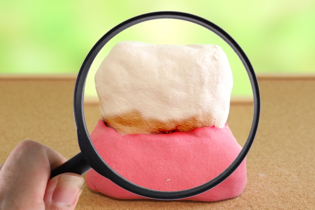 歯周病の治療回数はどのくらい？1回で治療が終わらない理由や通院の目安を解説