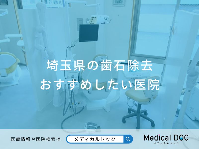 埼玉県の歯石除去おすすめしたい医院